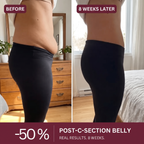 Seamless Sculpt Brief™ · Postpartum Support